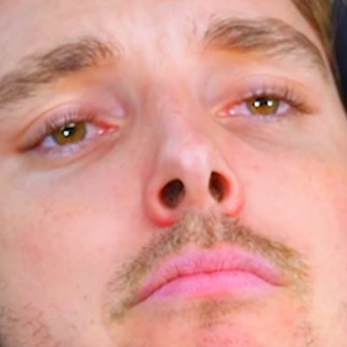 صورة LazarBeam الشخصية | RvewX